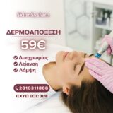 Προσφορά Δερμοαπόξεσης Μόνο 59€