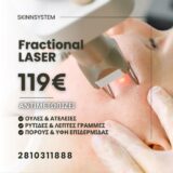 Fractional Laser Offer